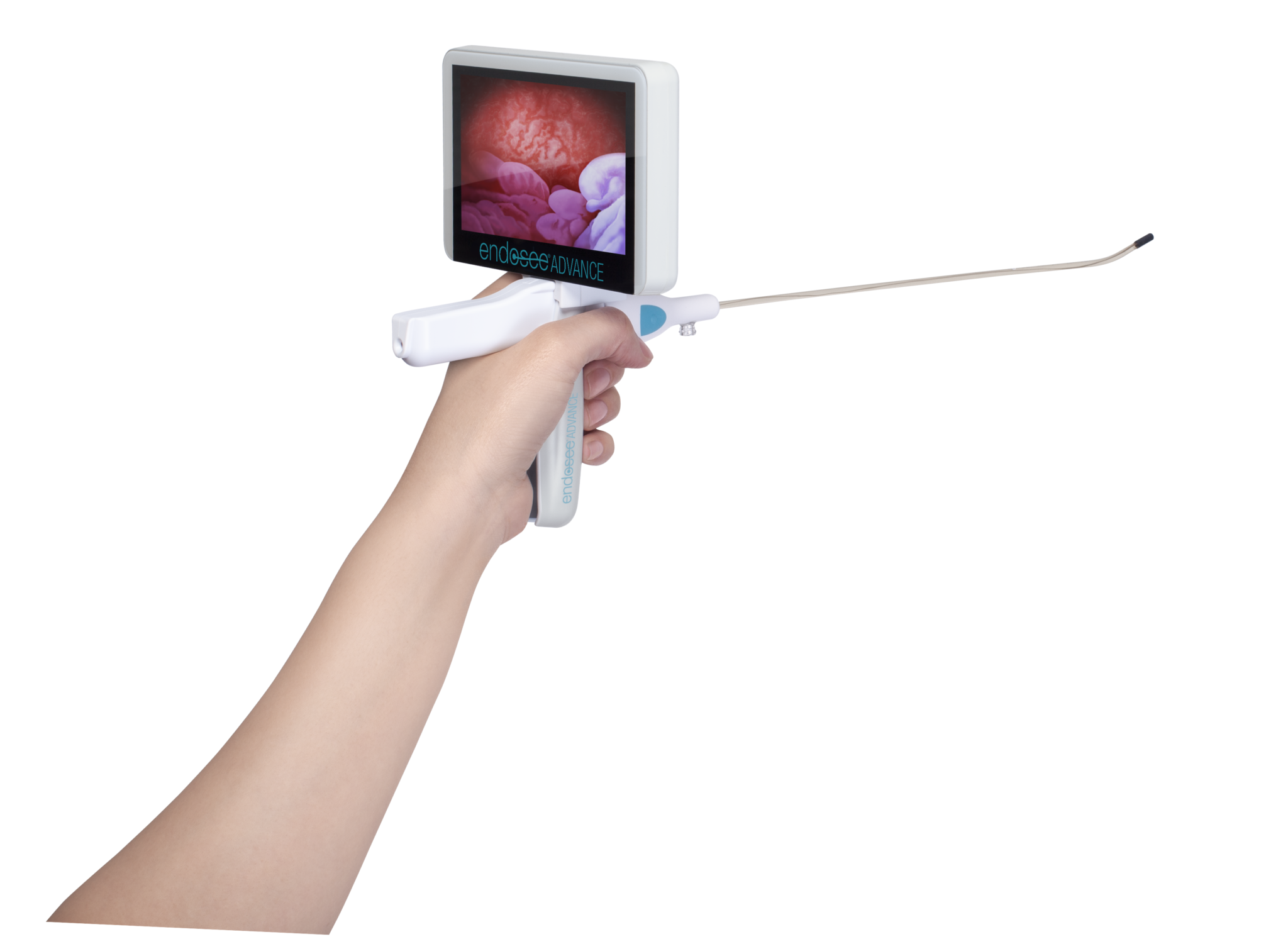 Endosee Advance kertakäyttöinen hysteroskooppi Mekalasi Oy