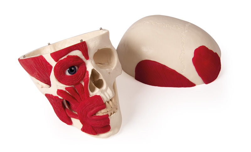 Kallo lihaksilla 18 x 19 x 12 cm