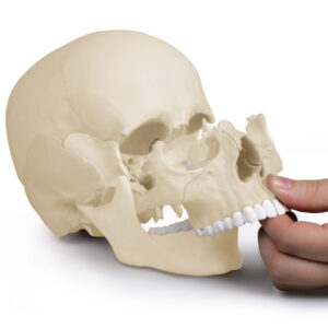 Kallo 22 osaa, osteopaattinen