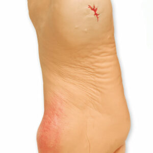 Yleiset jalkaongelmat malli 23 x 9.5 x 11.5 cm