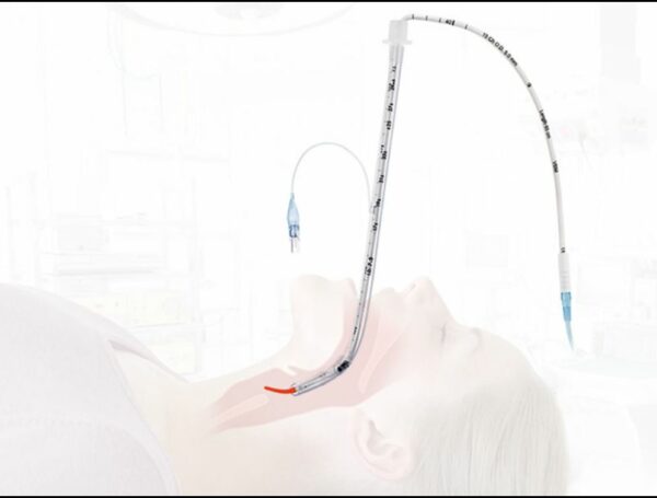 Intubaatioputken ohjain S-Guide 15Fr, pit. 65cm, kertak., steriili, 5kpl