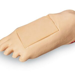 Turvonnut jalkaterä/kantapään painehaava tuotteisiin LF4001 ja LF4020