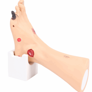 Jalkahaavasimulaattori "Wanda"