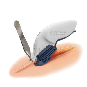 INSORB Skin Stapler -nitoja sulavilla hakasilla haavansulkuun