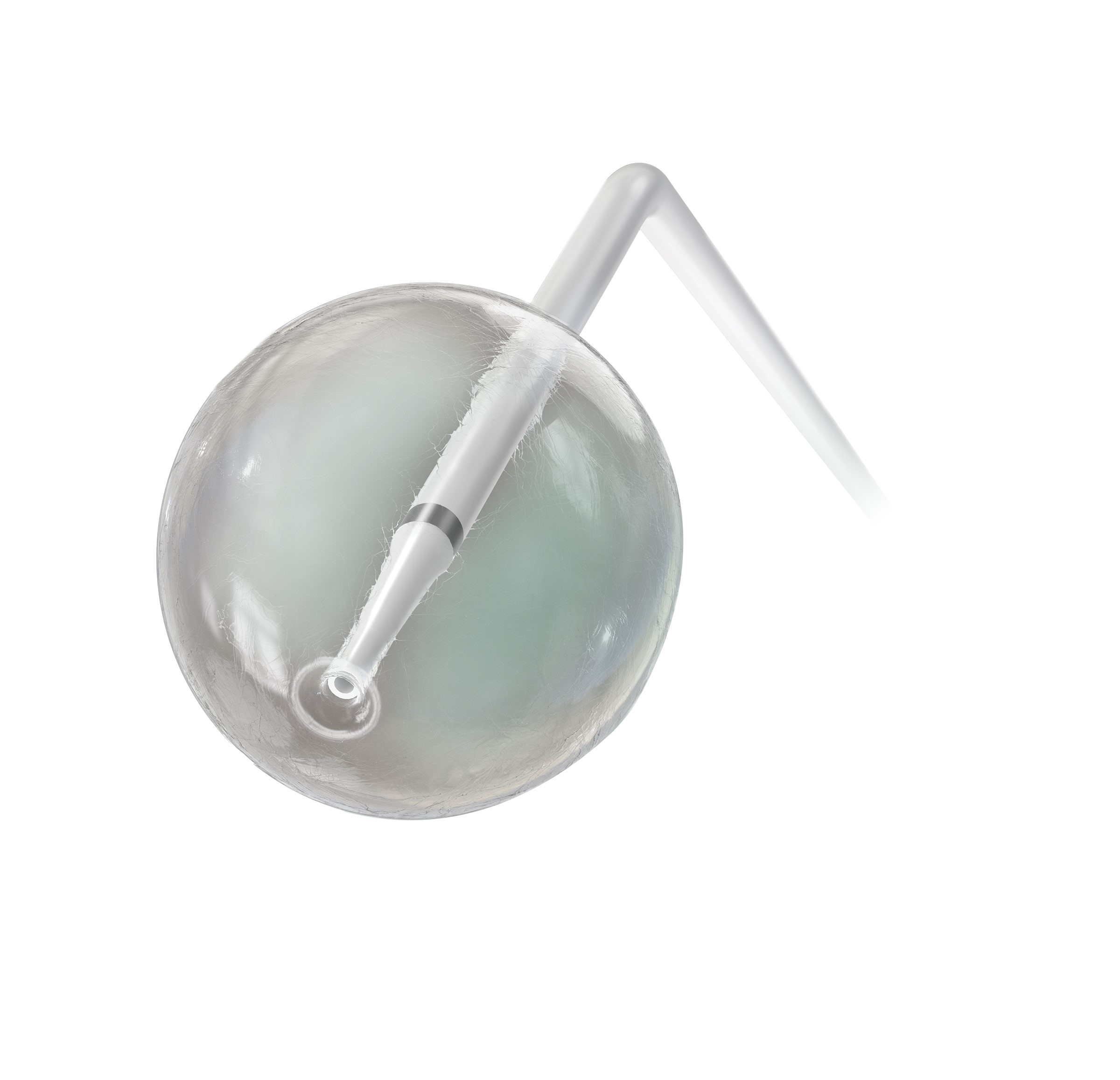 Z-5™ Atrioseptostomiakatetri Ø9.5 mm x 0.95 mm, 4 Fr, 50 cm